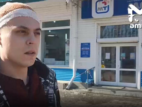 Сняли скальп разорвали ухо искусали как чувствует себя парень ставший жертвой собак в Хабаровске