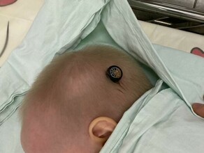 В Москве врачи вытащили из головы ребенка колесико от машинки фото видео