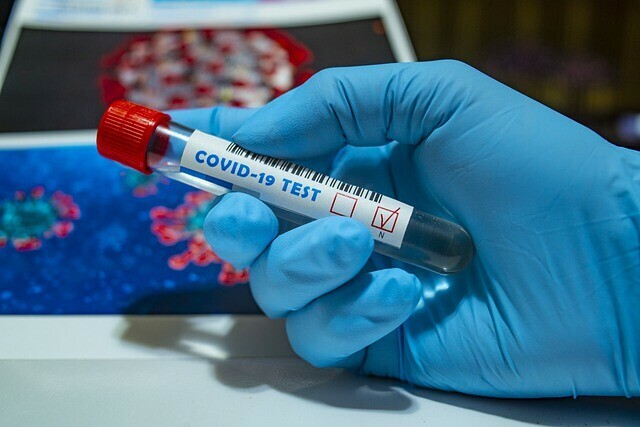 Зарегистрирован первый в России экспресстест для для обнаружения антител к COVID19 после вакцинации