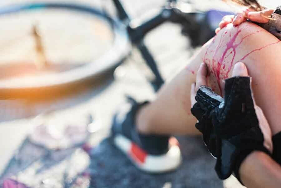 В Благовещенске мотоциклист сбил мальчикавелосипедиста и скрылся 