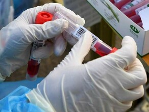 Академик РАН назвал причины невосприимчивости к коронавирусу