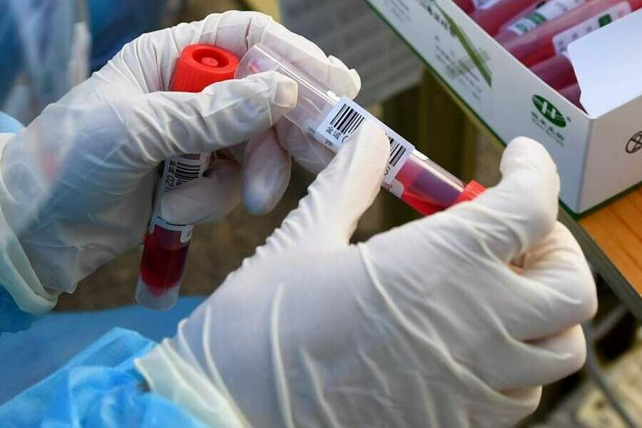 Академик РАН назвал причины невосприимчивости к коронавирусу