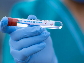 Количество заболевших коронавирусом в Амурской области увеличилось на 35 человек