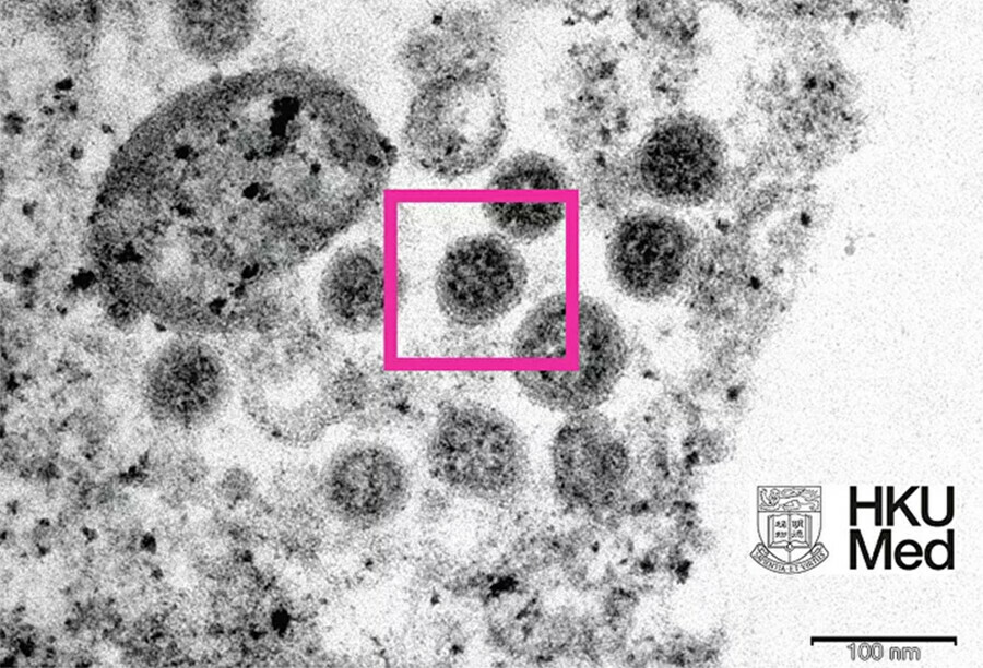 Опубликована первая электронная микрофотография омикронштамма коронавируса