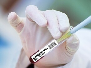 В России запатентовали препарат от коронавируса