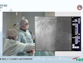 Амурские кардиохирурги провели операцию на сердце в онлайне За ходом наблюдали врачи из нескольких стран мира