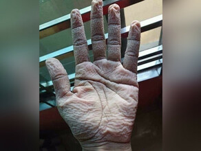 Рука  жесть в Приморье медики показали как выглядят руки врача после смены в ковидном госпитале