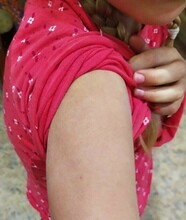 В детской больнице Благовещенска извинились перед родителями ребенка ошибочно привитого от гриппа второй раз 