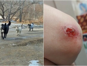 В Благовещенске собака напала и покусала двух детей на детской площадке Младшему всего 4 года