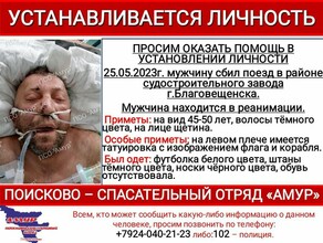 Пострадавший в коме в Благовещенске не могут установить личность мужчины которого сбил локомотив