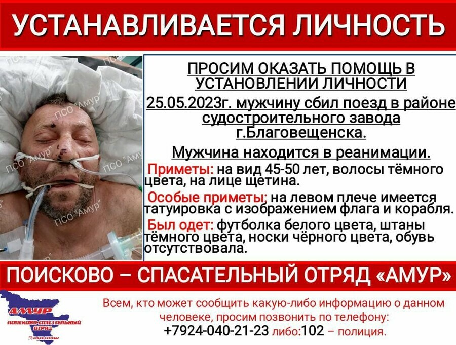 Пострадавший в коме в Благовещенске не могут установить личность мужчины которого сбил локомотив