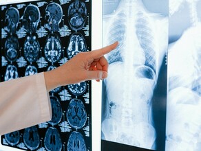 В Минздраве призывают не делать компьютерную томографию на всякий случай