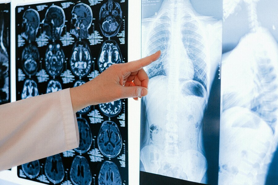 В Минздраве призывают не делать компьютерную томографию на всякий случай