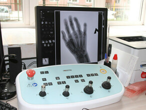 Жителей Белогорска будут обследовать на рентген аппарате и флюорографе нового поколения