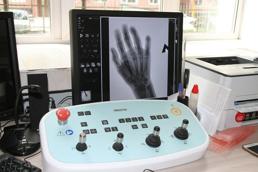 Жителей Белогорска будут обследовать на рентген аппарате и флюорографе нового поколения
