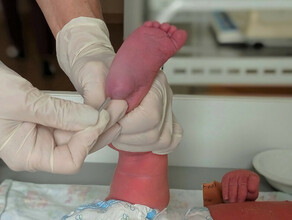 На 36 редких заболеваний проверяют новорожденных амурчан в АОКБ