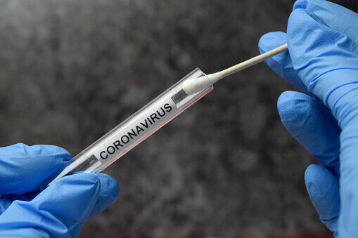 Оплачивать тесты на коронавирус из госбюджета предложили Роспотребнадзору РФ