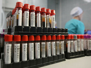 Правительство России ограничило госзакупку зарубежных пробирок для анализов крови