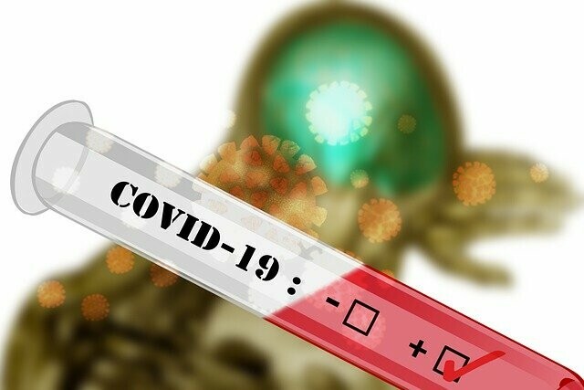 В Амурской области за сутки выявили еще 161 зараженного COVID19 У большинства  симптомы ОРВИ