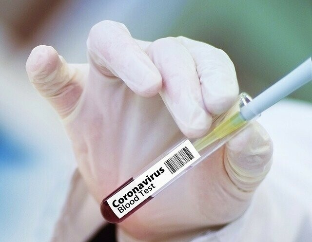 Плюс 169 число заразившихся COVID19  в Приамурье превысило 85 тысячи человек