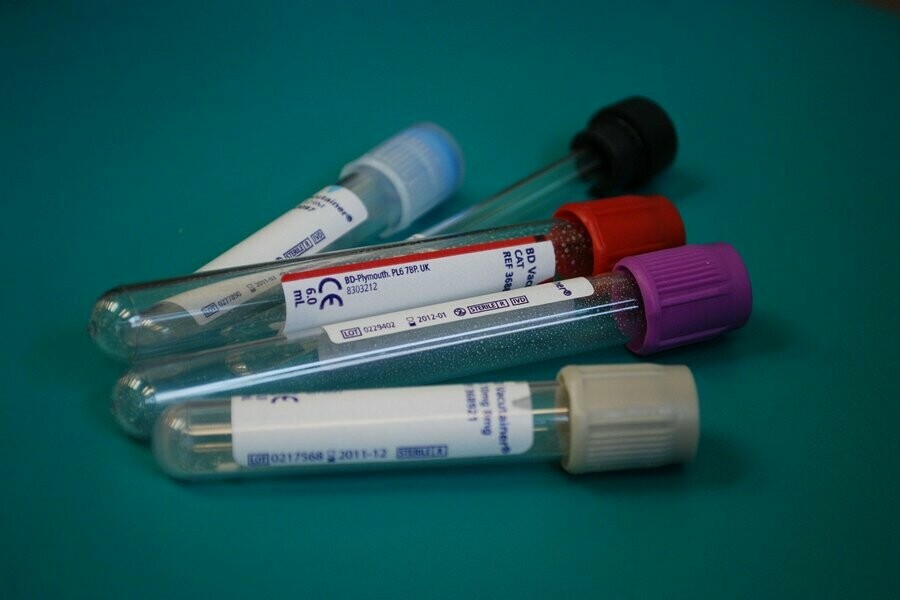 Амурская областная станция переливания крови ищет доноров плазмы которые переболели коронавирусом 