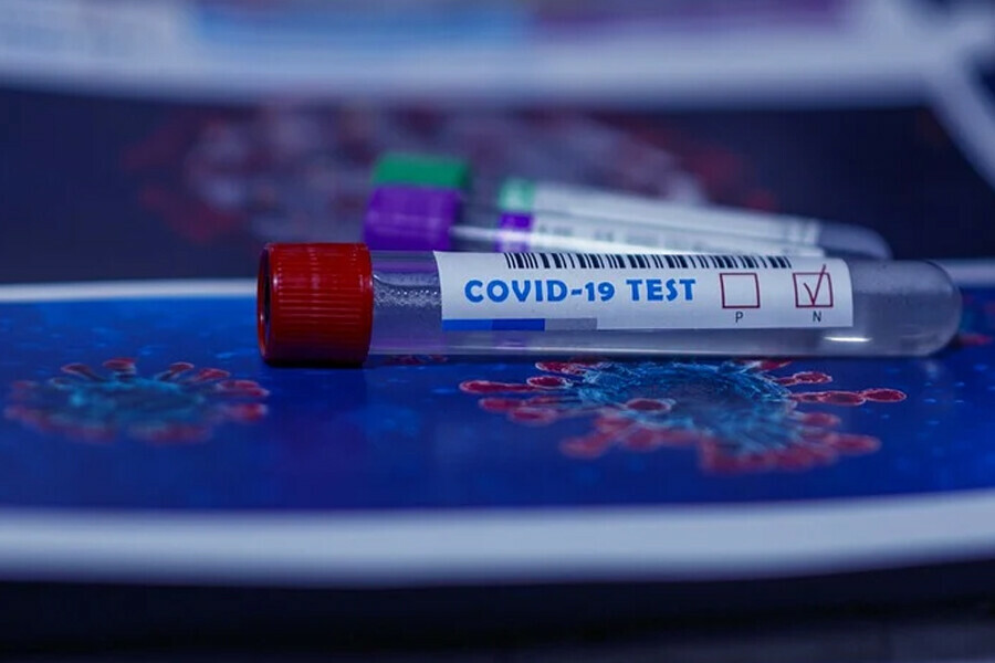 Рост числа заболевших COVID19 в Амурской области снова снизился Выявлено 157 новых случаев