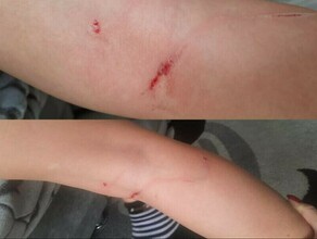 В Благовещенске после нападения собаки на ребенка по поручению главы СК РФ возбуждено уголовное дело 