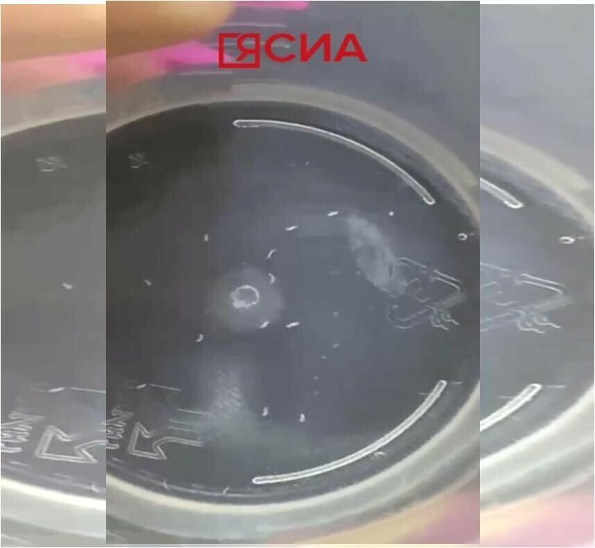 Удивило даже бывалых врачей на Дальнем Востоке в глазу пациентки были обнаружены личинки мухи видео