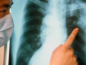 На Дальнем Востоке еще у одной сотрудницы школы выявили туберкулез Под угрозой ЕГЭ