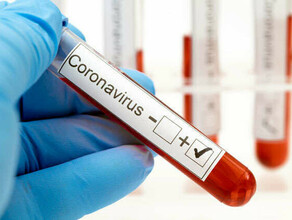 В Амурской области выявлено 146 новых случаев коронавируса