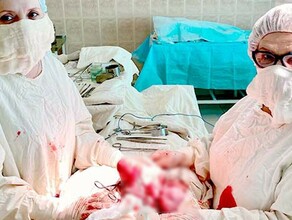 Огромную опухоль удалили гинекологи у пациентки забывшей дорогу к врачам