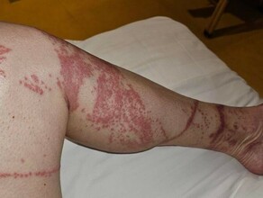 Не было предупреждений благовещенку экстренно госпитализировали в Таиланде после купания в море фото 