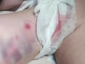 В Свободном по факту нападения собаки на женщину возбуждено уголовное дело