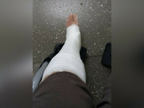 Благовещенка упала на обледеневшем крыльце больницы и обратилась в суд