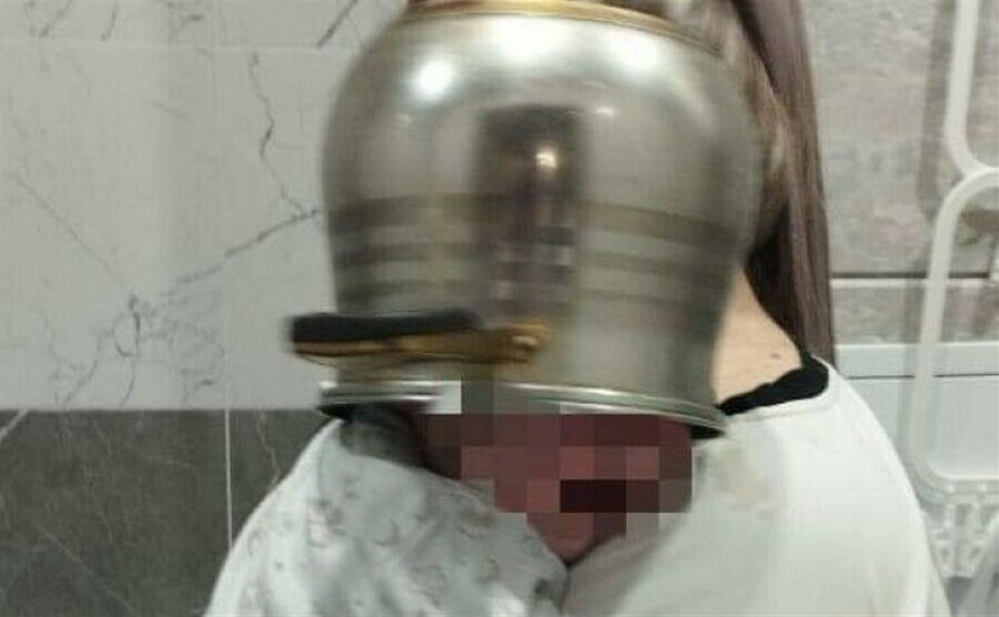 Двухлетний малыш застрял головой в кастрюле