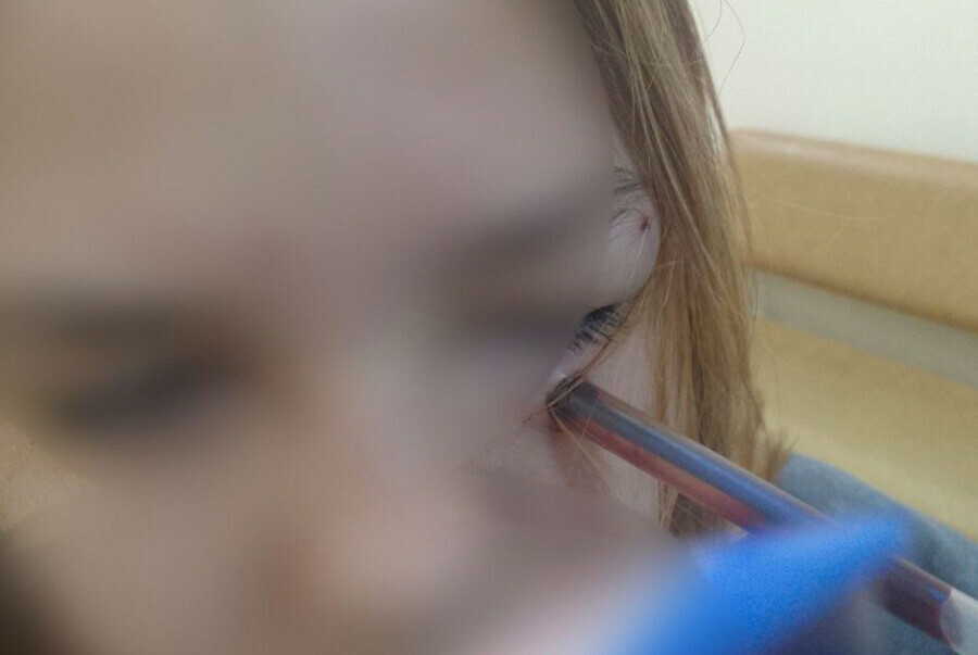 Школьник зверски воткнул ручку в глаз однокласснице фото 18