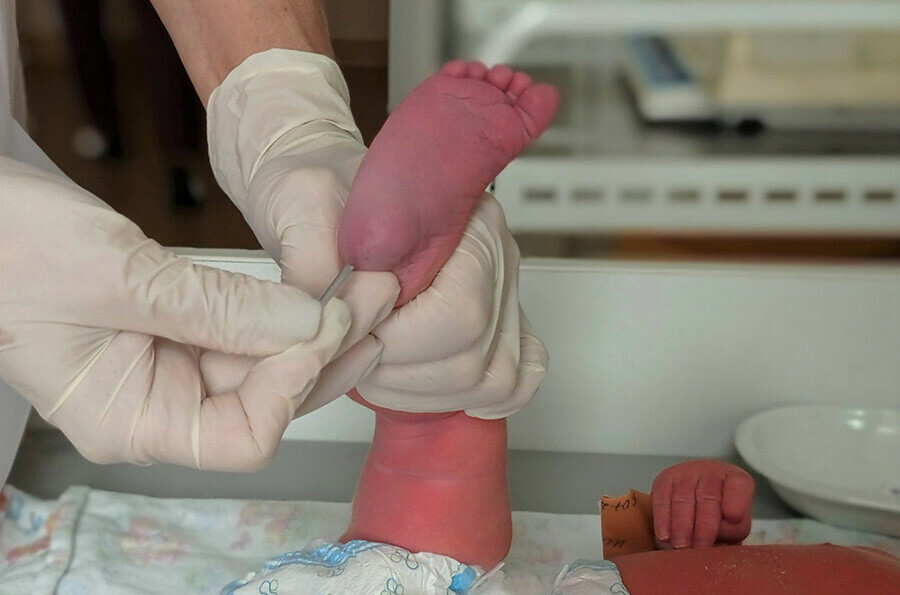 В Амурской области неонатальный скрининг помог выявить у новорожденного редкое генетическое заболевание