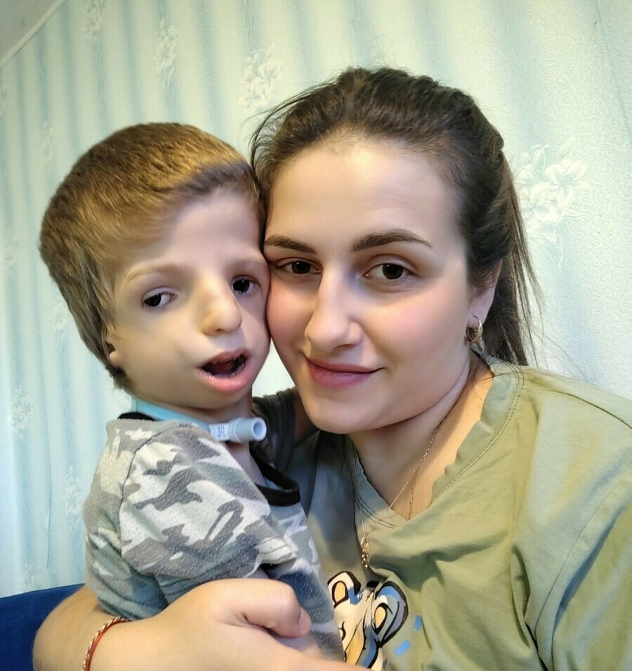 Мне пишут почему ты его не усыпила Амурчанка Диана Савченко откровенно рассказала о своем сыне с редким диагнозом 