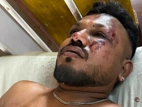 Вокруг были тела один человек чудом выжил в крупнейшей в мире авиакатастрофе