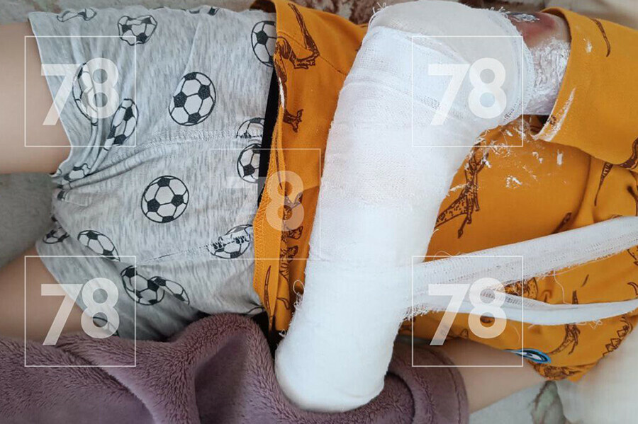 На жд вокзале руку маленького ребенка затянуло в аппарат для досмотра сумок видео