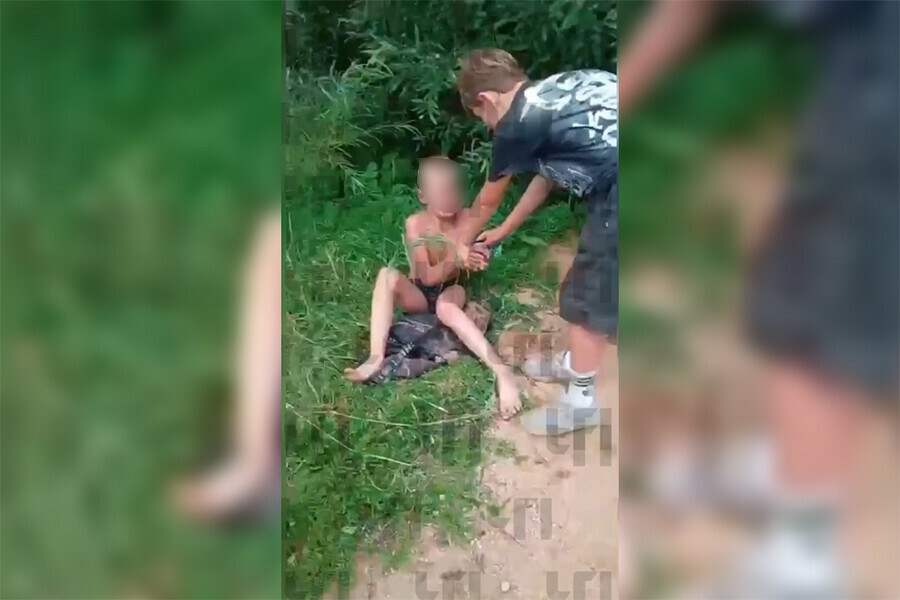 По факту избиения 9летнего мальчика в Шимановске возбуждено уголовное дело