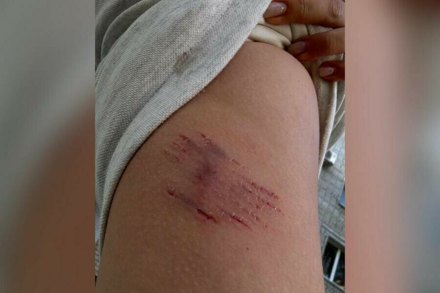 В центре Благовещенска на девушку напала бродячая собака
