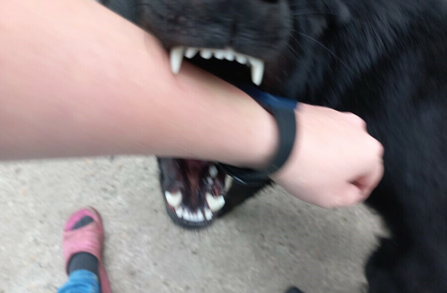 В Свободном девочку сильно покусала бродячая собака