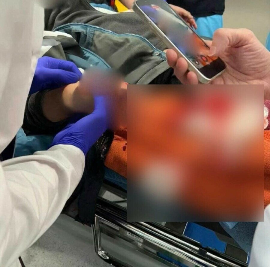 Мальчик поднял деньги с земли и раздался взрыв