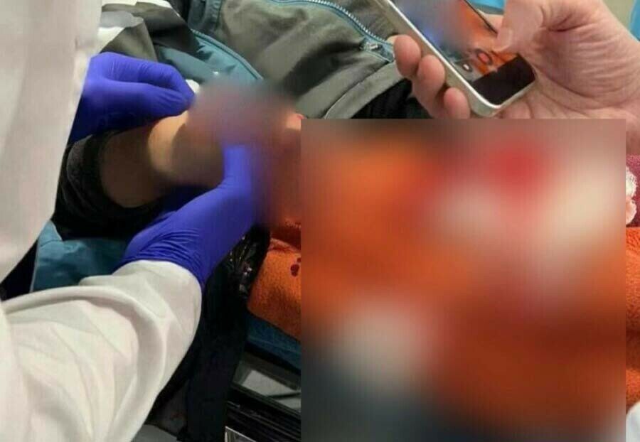 Мальчику поднявшему замаскированное взрывное устройство провели сложную 6часовую операцию