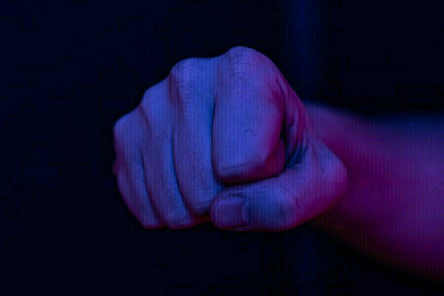 От тяжелейшей черепномозговой травмы в Серышеве скончался 57летний мужчина