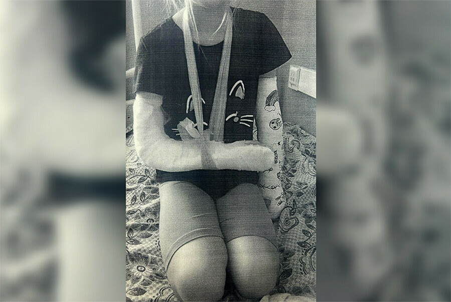 Девочка сломала обе руки катаясь на самокате по набережной Благовещенска Мать обратилась в суд