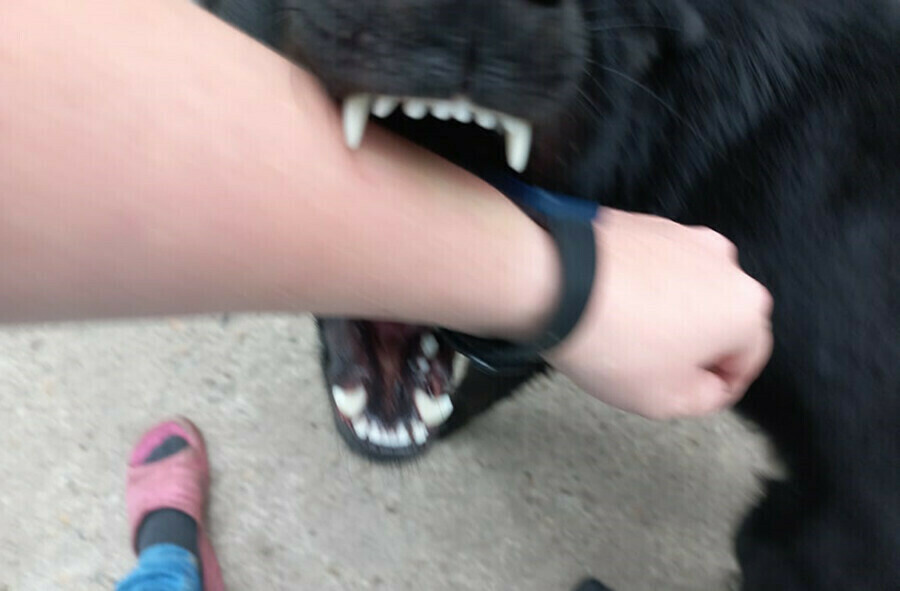 Стая собак напала на девочку в Тынде