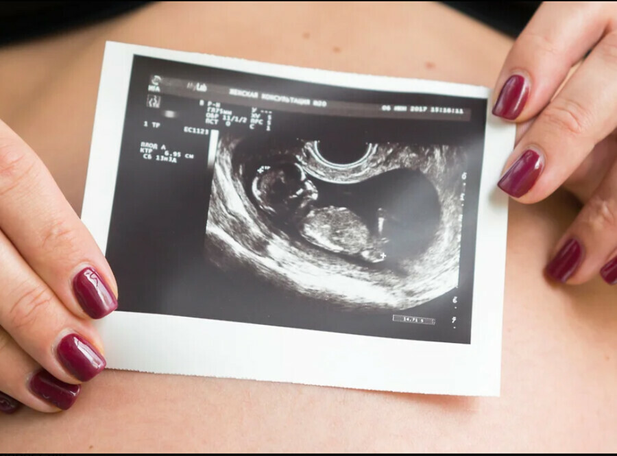 Регионы начали отчитываться о выполнении плана по беременным студенткам