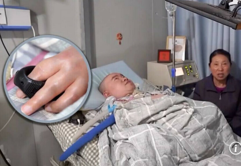 Парализованный мужчина придумал систему умной фермы используя всего один работающий палец